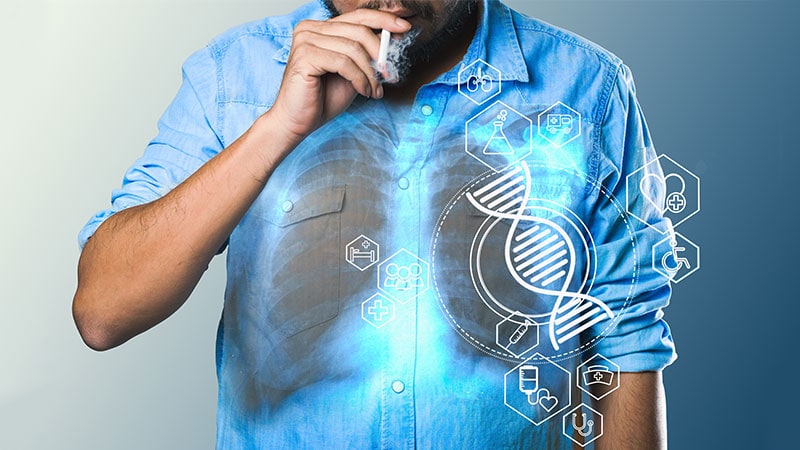 Genetic Profiles Affect Lung Cancer Risk in Smokers