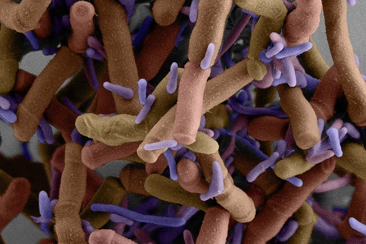 Genetic tools investigate microbial dark matter